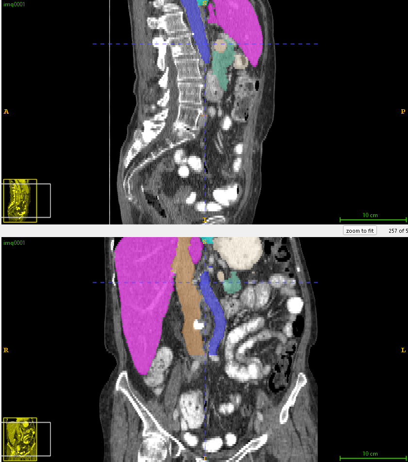 cross-sectional anatomy representing UNETR 3D segmentation