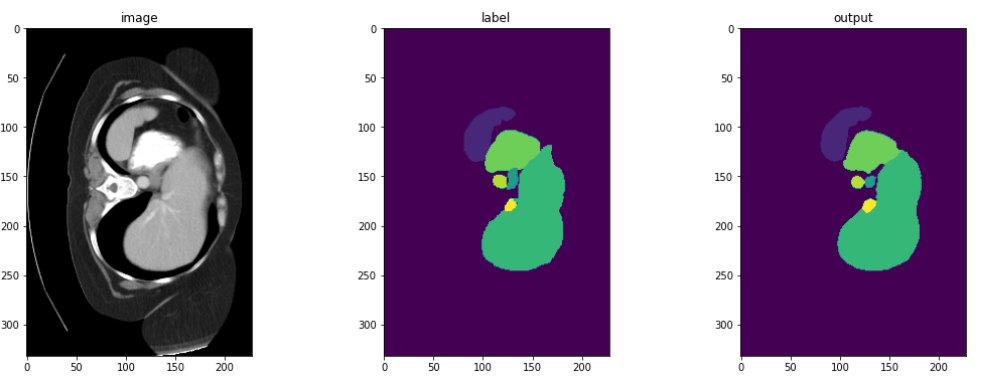 Segmentation Visualization